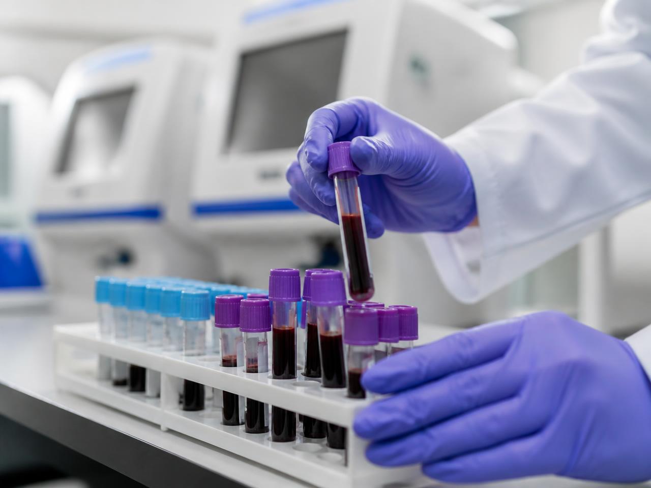 Tubos de coleta e materiais do laboratório VitaGene